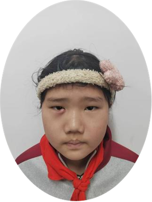 诗