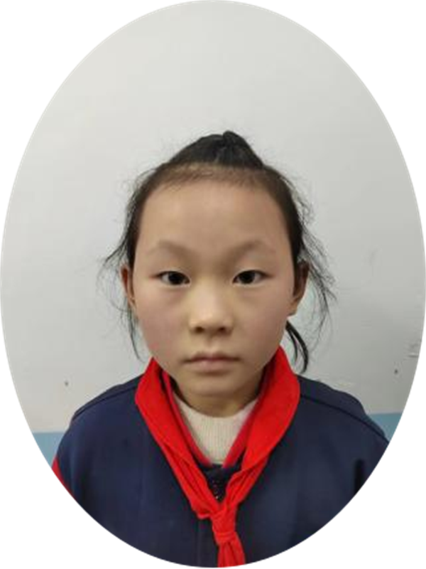 苹果牙医正阳县第三小学 四（4）班 卢孟