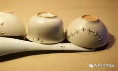 陈华卿专栏 | 记亿里的锔盆声