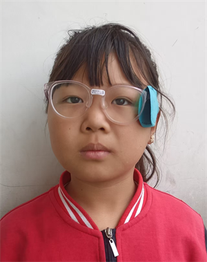 余